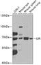 Lamin B Receptor antibody, GTX32697, GeneTex, Western Blot image 