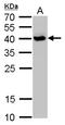 SH3 Domain Containing GRB2 Like 3, Endophilin A3 antibody, GTX114758, GeneTex, Western Blot image 
