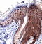 Collagen Type I Alpha 1 Chain antibody, TA336830, Origene, Immunohistochemistry paraffin image 