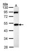 Membrane Palmitoylated Protein 1 antibody, TA308069, Origene, Western Blot image 