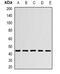 CHRNA7 (Exons 5-10) And FAM7A (Exons A-E) Fusion antibody, abx141429, Abbexa, Western Blot image 