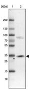 Cathepsin Z antibody, PA5-62072, Invitrogen Antibodies, Western Blot image 