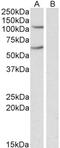 Iron Responsive Element Binding Protein 2 antibody, STJ71965, St John