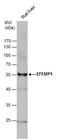 EGF Containing Fibulin Extracellular Matrix Protein 1 antibody, PA5-29347, Invitrogen Antibodies, Western Blot image 