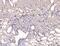 YY1 Transcription Factor antibody, M00833-2, Boster Biological Technology, Immunohistochemistry paraffin image 