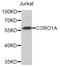 G protein subunit beta-2 antibody, orb374113, Biorbyt, Western Blot image 