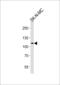NOC3 Like DNA Replication Regulator antibody, 57-392, ProSci, Western Blot image 