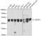 Ubiquinol-Cytochrome C Reductase Core Protein 1 antibody, 19-039, ProSci, Western Blot image 
