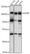 Centrosomal Protein 85 antibody, A15891, ABclonal Technology, Western Blot image 