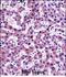 Nicotinamide N-Methyltransferase antibody, PA5-48630, Invitrogen Antibodies, Immunohistochemistry frozen image 