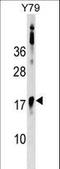 BAF Chromatin Remodeling Complex Subunit BCL7B antibody, LS-C159172, Lifespan Biosciences, Western Blot image 