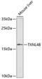 Thioredoxin Like 4B antibody, 22-711, ProSci, Western Blot image 