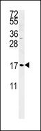 Small Cell Adhesion Glycoprotein antibody, 61-866, ProSci, Western Blot image 