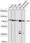 Iduronate 2-Sulfatase antibody, A00180, Boster Biological Technology, Western Blot image 