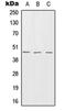 SERPINB7 antibody, orb214818, Biorbyt, Western Blot image 