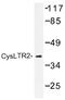 Cysteinyl Leukotriene Receptor 2 antibody, AP01297PU-N, Origene, Western Blot image 