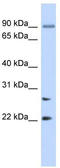 Josephin Domain Containing 2 antibody, TA340284, Origene, Western Blot image 