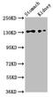 Filamin A Interacting Protein 1 Like antibody, LS-C377627, Lifespan Biosciences, Western Blot image 