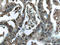 Galectin 1 antibody, 60223-1-Ig, Proteintech Group, Immunohistochemistry paraffin image 