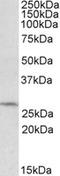 Defective In Cullin Neddylation 1 Domain Containing 1 antibody, LS-B9526, Lifespan Biosciences, Western Blot image 