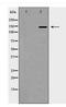 SOS Ras/Rho Guanine Nucleotide Exchange Factor 2 antibody, TA347930, Origene, Western Blot image 