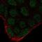 RAK antibody, NBP2-68617, Novus Biologicals, Immunofluorescence image 