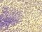 HLA class I histocompatibility antigen protein P5 antibody, orb46399, Biorbyt, Immunohistochemistry paraffin image 