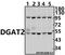 Diacylglycerol O-acyltransferase 2 antibody, A03174, Boster Biological Technology, Western Blot image 