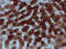 Migration And Invasion Enhancer 1 antibody, M07379, Boster Biological Technology, Immunohistochemistry paraffin image 