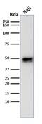 CD79a antibody, GTX17720, GeneTex, Western Blot image 