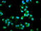 DNA Cross-Link Repair 1B antibody, LS-C680365, Lifespan Biosciences, Immunofluorescence image 