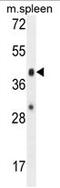 Acyl-CoA Wax Alcohol Acyltransferase 2 antibody, AP50318PU-N, Origene, Western Blot image 