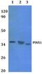 PIN2 (TERF1) Interacting Telomerase Inhibitor 1 antibody, PA5-75853, Invitrogen Antibodies, Western Blot image 