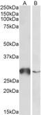 Glutathione S-Transferase Omega 1 antibody, TA329073, Origene, Western Blot image 