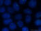 Centrosome-associated protein CEP250 antibody, 14498-1-AP, Proteintech Group, Immunofluorescence image 