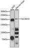 Solute Carrier Family 4 Member 10 antibody, LS-C748839, Lifespan Biosciences, Western Blot image 