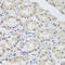 Argonaute RISC Catalytic Component 2 antibody, LS-C334953, Lifespan Biosciences, Immunohistochemistry paraffin image 