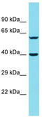 DnaJ Heat Shock Protein Family (Hsp40) Member B14 antibody, TA336037, Origene, Western Blot image 