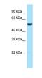 WAS/WASL Interacting Protein Family Member 1 antibody, orb330992, Biorbyt, Western Blot image 