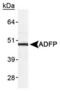 Perilipin 2 antibody, TA301422, Origene, Western Blot image 