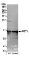 Neuroepithelial Cell Transforming 1 antibody, A303-138A, Bethyl Labs, Western Blot image 