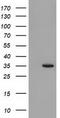 Sulfotransferase 1A1 antibody, LS-C172402, Lifespan Biosciences, Western Blot image 
