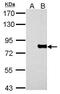 MX Dynamin Like GTPase 1 antibody, GTX111153, GeneTex, Western Blot image 