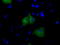 Bruton Tyrosine Kinase antibody, TA501091, Origene, Immunofluorescence image 