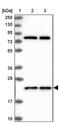 Jupiter Microtubule Associated Homolog 2 antibody, PA5-59774, Invitrogen Antibodies, Western Blot image 