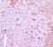 C-Reactive Protein antibody, A00249-4, Boster Biological Technology, Immunohistochemistry paraffin image 