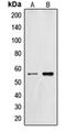 Zinc Finger And SCAN Domain Containing 26 antibody, orb214756, Biorbyt, Western Blot image 