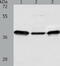 Calponin 3 antibody, TA323111, Origene, Western Blot image 
