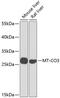 Cytochrome c oxidase subunit 3 antibody, GTX66589, GeneTex, Western Blot image 