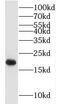 Myosin regulatory light chain 2, ventricular/cardiac muscle isoform antibody, FNab05486, FineTest, Western Blot image 
